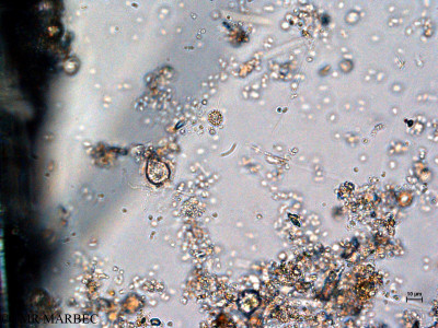 phyto/Thau_Lagoon/THAU_station1/GELAMED 2010/Acanthoica quattrospina (2)(copy)_thumb.jpg